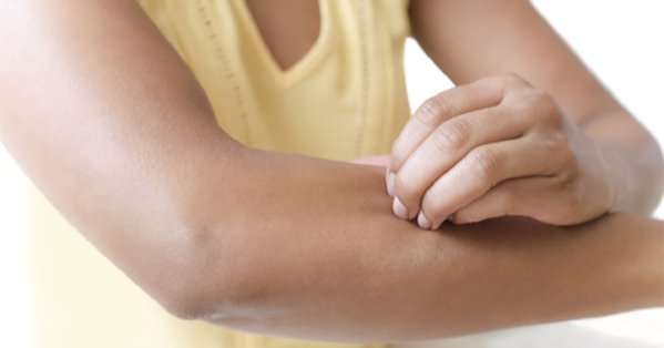 دواء واعد يخفف الحكة بسرعة لدى مرضى الإكزيما 