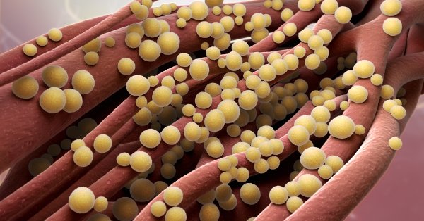 طبيبة تكشف عن تغييرات فعّالة لخفض الكوليسترول 