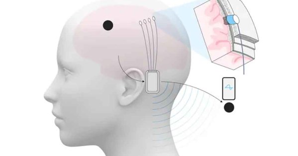 ماسك:"نيورالينك" تخطط لإنتاج كميات كبيرة من شرائح الدماغ في 2026 #صحيفة_البلاد 