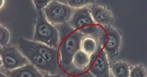 كشف سرطان البنكرياس.. "باندا" تتفوق على الأطباء 