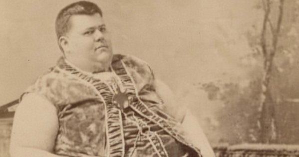 أسمن رجل في القرن الـ19 كان الناس يدفعون لرؤية حجم بطنه! #صحيفة_البلاد 