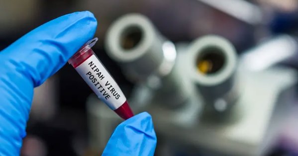 لقاح ضد فيروس نيباه يدخل التجارب البشرية لأول مرة 